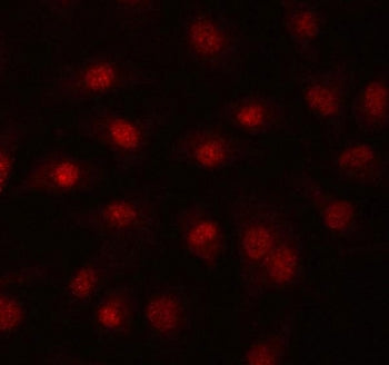 PRPF39 Antibody / Pre-mRNA-processing factor 39