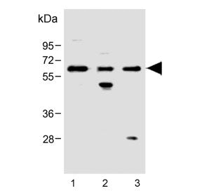 FCGR1B Antibody