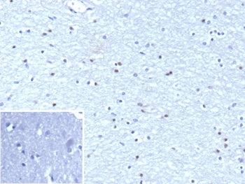 IHC staining of FFPE human brain tissue with Oligodendrocyte transcription factor 2 antibody (clone