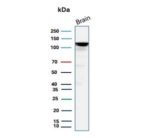 Western blot testing of human brain tissue lysate with Hexokinase 1 antibody (clone HK1/9504). Predi