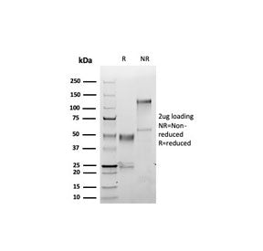 SDS-PAGE analysis of purified, BSA-free S100A1 antibody (clone S100A1/6374R) as confirmation of inte