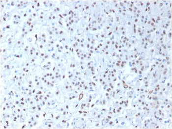 WT1 Antibody / Wilms Tumor 1