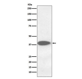 Western blot testing of human A375 cell lysate with CTSB antibody. Molecular weight: 38-46 kDa depen