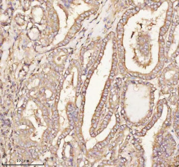 Immunohistochemical staining of PTCD1 using anti-PTCD1 antibody. PTCD1 was detected in a paraffin-em
