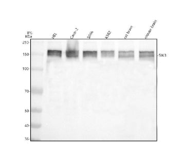 Western blot analysis of SIK3 using anti-SIK3 antibody. Electrophoresis was performed on a 8% SDS-PA