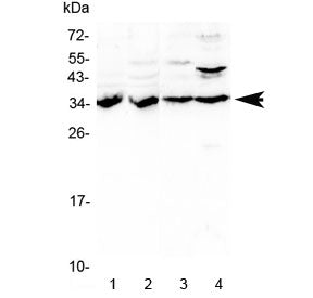 Western blot testing of 1) rat kidney, 2) rat liver, 3) mouse liver and 4) human HeLa lysate with BR