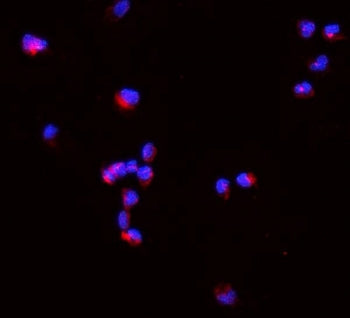 Tnf alpha Antibody