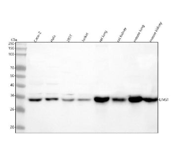 Western blot analysis of LIMS1 using anti-LIMS1 antibody. Lane 1: human Caco-2 whole cell lysates, L