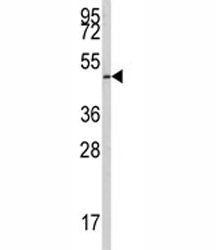 E2F1 Antibody