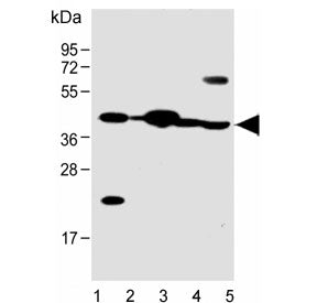 Western blot testing of human 1) HeLa, 2) placenta, 3) heart, 4) mouse heart and 5) rat heart lysate