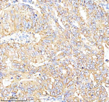 Immunohistochemical staining of Choriogonadotropin alpha/CGA using anti-CGA antibody. Choriogonadotr