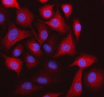 Immunofluorescent staining of STOML3 using anti-STOML3 antibody. STOML3 was detected in an immunocyt