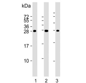 Western blot testing of mouse 1) kidney, 2) stomach and 3) liver lysate with PSCA antibody. Expected