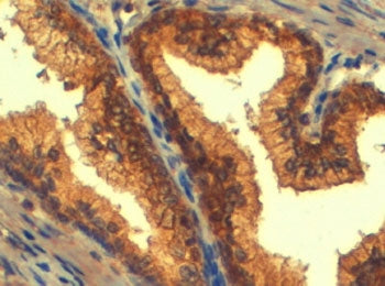 IHC testing of FFPE human prostate with ABCC4 antibody at 4ug/ml. HIER: steamed with pH6 citrate buf