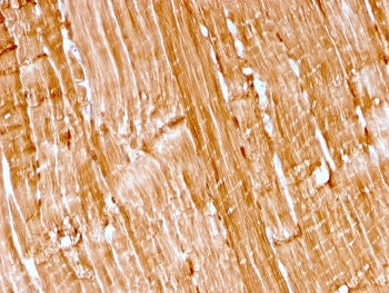 IHC staining of FFPE human skeletal muscle with recombinant Myoglobin antibody (rMB/2105). HIER: boi
