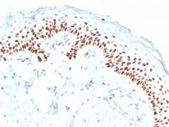 p40 / deltaNp63 Antibody