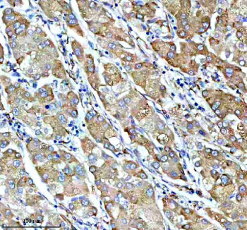 IHC analysis of SUCO using anti-SUCO antibody. SUCO was detected in a paraffin-embedded section of h