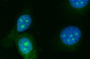Immunofluorescent staining of FFPE human PC-3 cells with RRS1 antibody (green) and DAPI nuclear stai