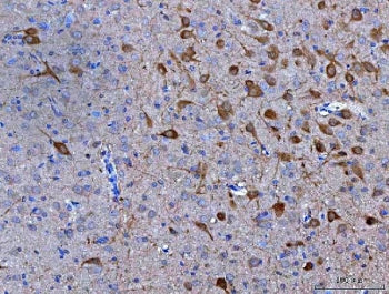 Nms Antibody / Neuromedin-S