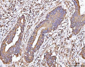 MICALL2 Antibody / MICAL-like protein 2
