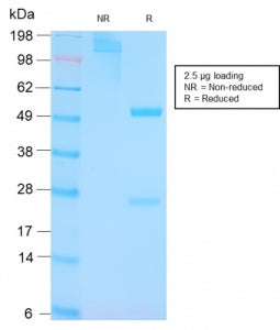 p53 Antibody / TP53