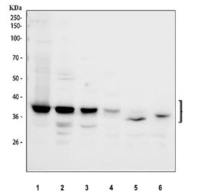 Western blot testing of 1) human 293T, 2) human Jurkat, 3) human U-251, 4) human A549, 5) rat spleen