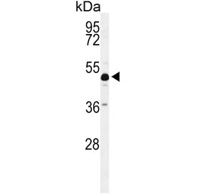 ANKH Antibody