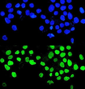 MMP28 Antibody