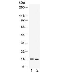 Western blot testing of 1) human A431 and 2) MCF7 cell lysate with S100A9 antibody. Expected/observe