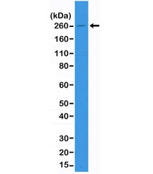 ACC Antibody / Acetyl CoA Carboxylase