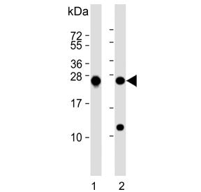 Western blot testing of human 1) K562 and 2) MCF7 cell lysate with PSMB1 antibody. Predicted molecul