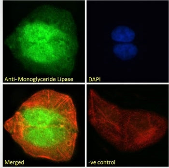 Immunofluorescent staining of fixed and permeabilized human U-2 OS cells with Monoglyceride lipase a