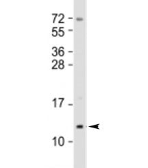 Western blot testing of human T47D cell lysate (mammary gland) with Mammaglobin A antibody at 1:2000