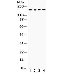 Western blot testing of human 1) 293, 2) SW620, 3) COLO320 and 4) HeLa cell lysate with HKDC1 antibo