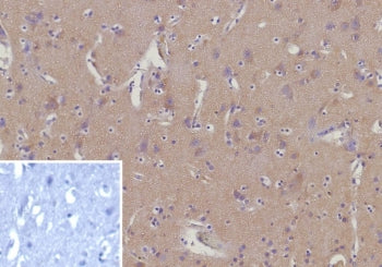 IHC staining of FFPE human brain tissue with CD135 antibody (clone FLT3/9888). Inset: PBS used in pl