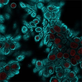 Immunofluorescent staining of human HeLa cells with pan Cytokeratin antibody cocktail (clone Cocktai