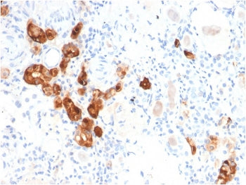 IHC staining of FFPE human kidney with Calbindin antibody (clone CALB1/2782). HIER: boil tissue sect