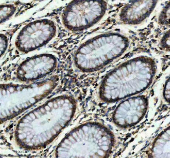 Immunohistochemical staining of ITGB7 using anti-ITGB7 antibody. ITGB7 was detected in a paraffin-em
