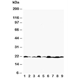 Western blot testing of Bax antibody and Lane 1: rat testis; 2: rat kidney; 3: (r) brain; 4: (r) ova
