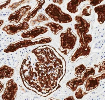 IHC testing of FFPE human kidney tissue with CD10 antibody. HIER: steam section in pH6 citrate buffe