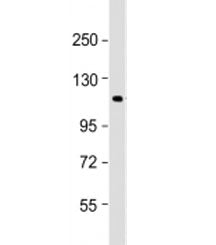 PTPN12 Antibody