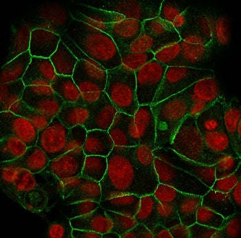 Immunofluorescent staining of human MCF7 cells with E-Cadherin antibody (clone SPM471, green) and Re