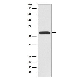 IRF6 Antibody / Interferon Regulatory Factor 6