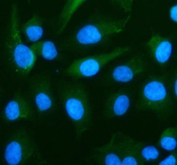 Immunofluorescent staining of RPS19 using anti-RPS19 antibody (green). RPS19 was detected in an immu