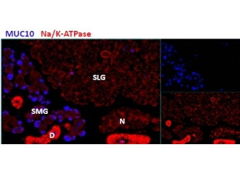 IHC testing of cells in the submandibular salivery gland (SMG), but not in the sublingual salivery g
