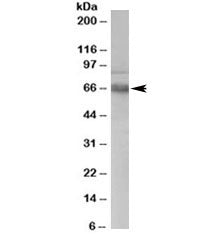 Western blot testing of human PBMC lysate with ATR antibody at 0.3ug/ml. Expected molecular weight: