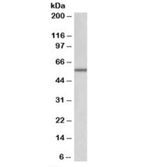 Western blot testing of mouse kidney lysate with ALDH6A1 antibody at 0.1ug/ml. Predicted molecular w