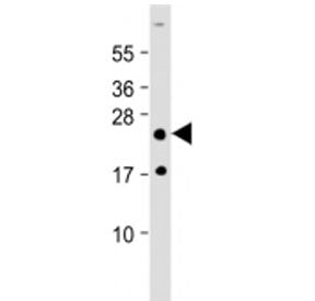 Western blot testing of HOXA7 antibody at 1:2000 + human skeletal muslce lysate. Predicted molecular