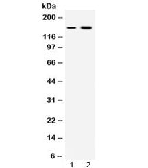 Western blot testing of 1) rat kidney and 2) human HepG2 lysate with Insulin Receptor antibody at 0.