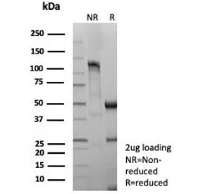 SDS-PAGE analysis of purified recombinant CD8 alpha antibody (clone rCD8/9211) as confirmation of in